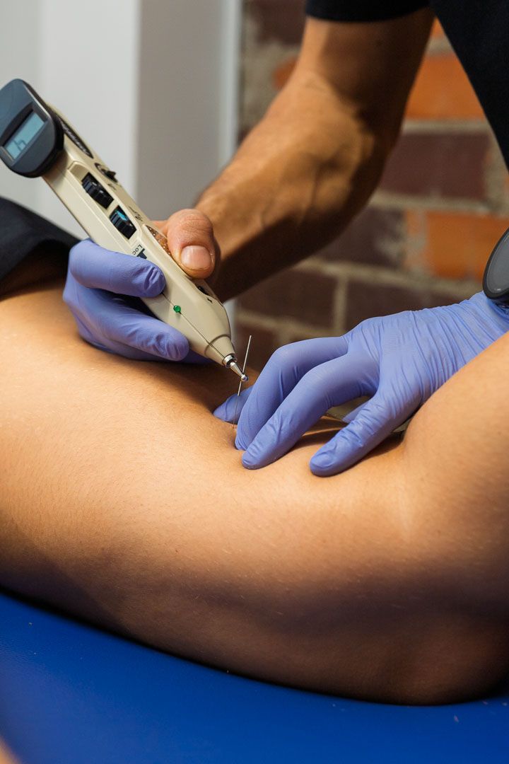 Punción seca y neuromodulación percutánea con electroestimulación